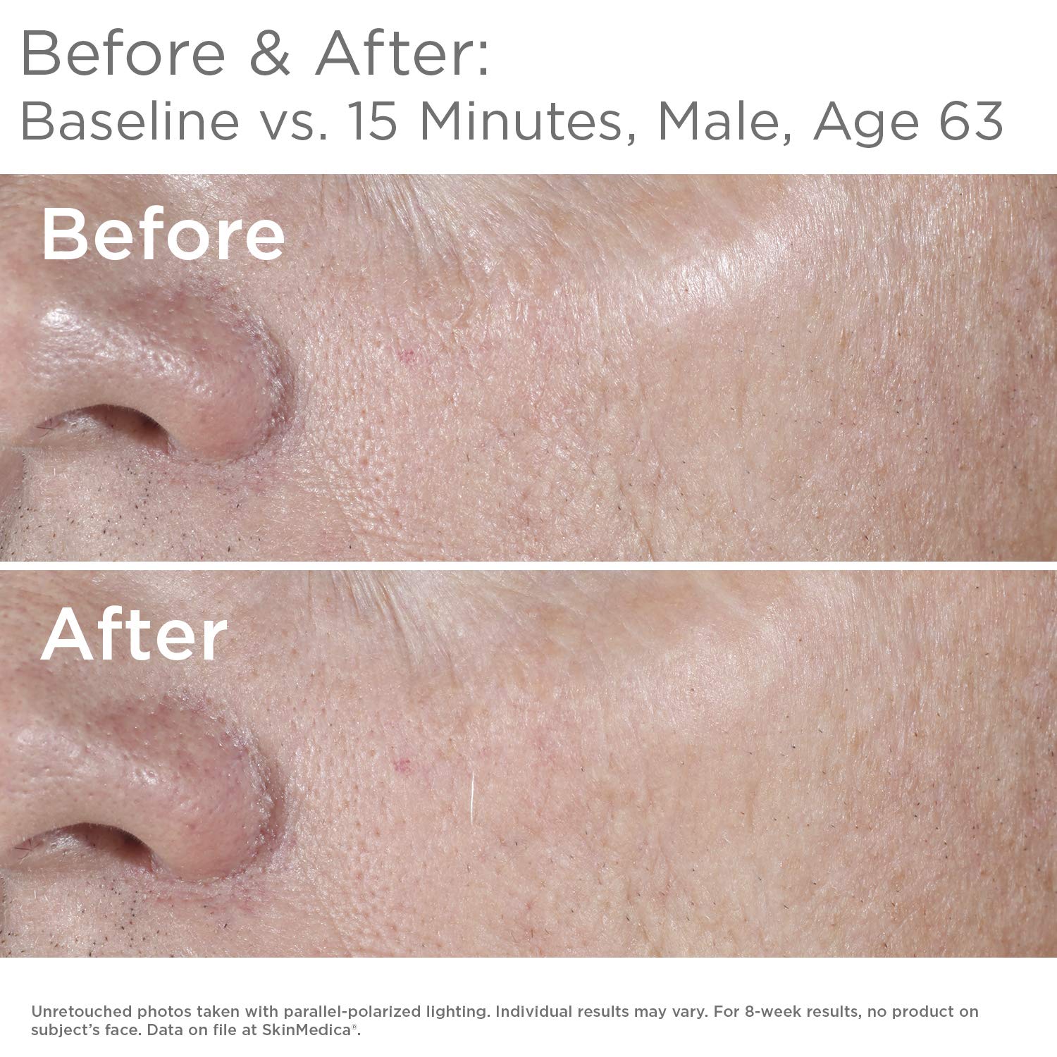 Foto 6 | Serum Skinmedica Ha5 Hidratante Rejuvenecedor De Ácido Hialurónico 30 Ml - Venta Internacional.