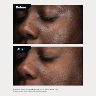 Foto 5 | Serum Revision Skincare D·e·j Daily Boosting 30 Ml Antienvejecimiento - Venta Internacional.
