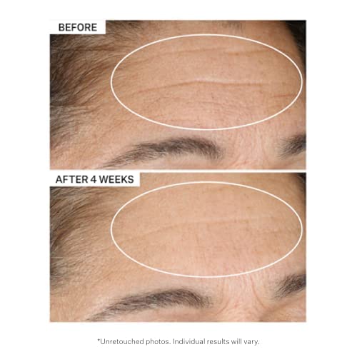 Foto 5 pulgar | Crema Hidratante Strivectin Advanced Retinol Intensive Night 30 Ml - Venta Internacional.