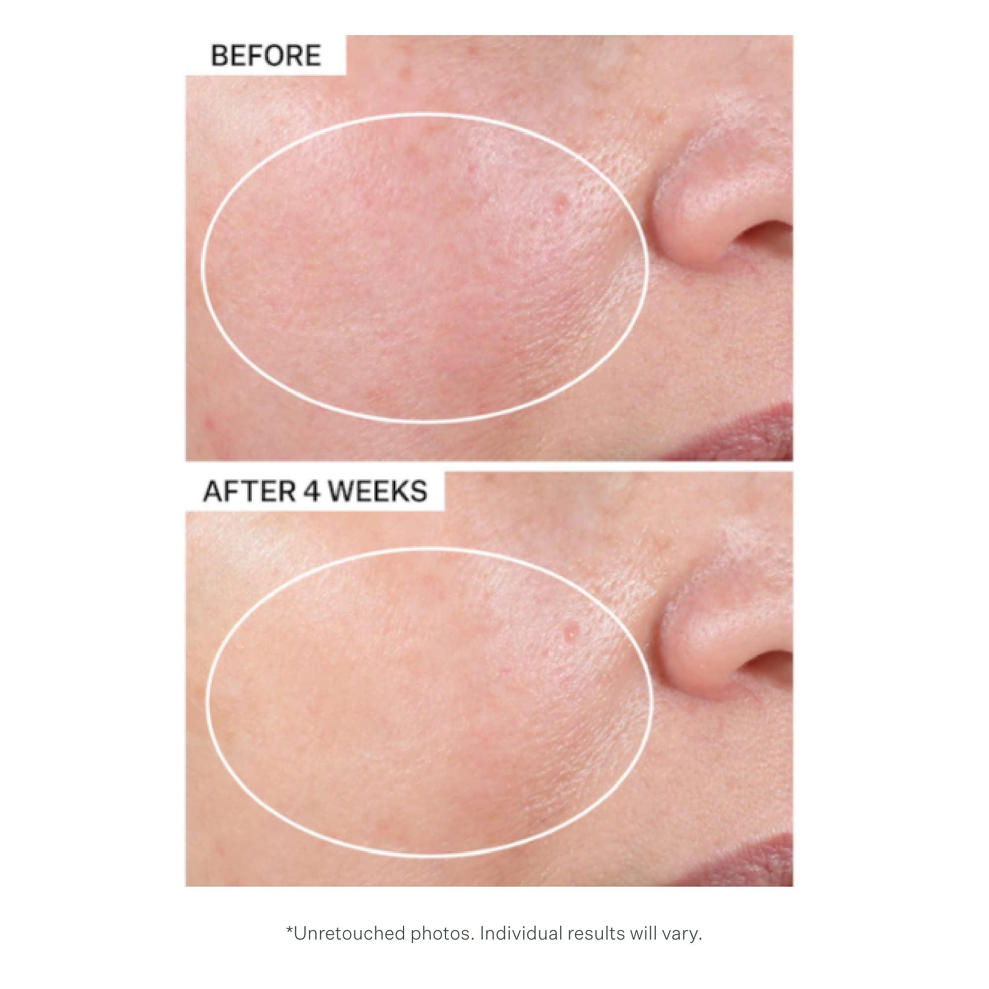 Foto 6 pulgar | Crema Hidratante Strivectin Advanced Retinol Intensive Night 30 Ml - Venta Internacional.