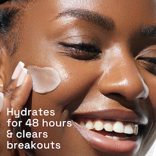 Foto 4 | Crema Hidratante Cetaphil Gentle Clear Matificante Acné 90 Ml - Venta Internacional.