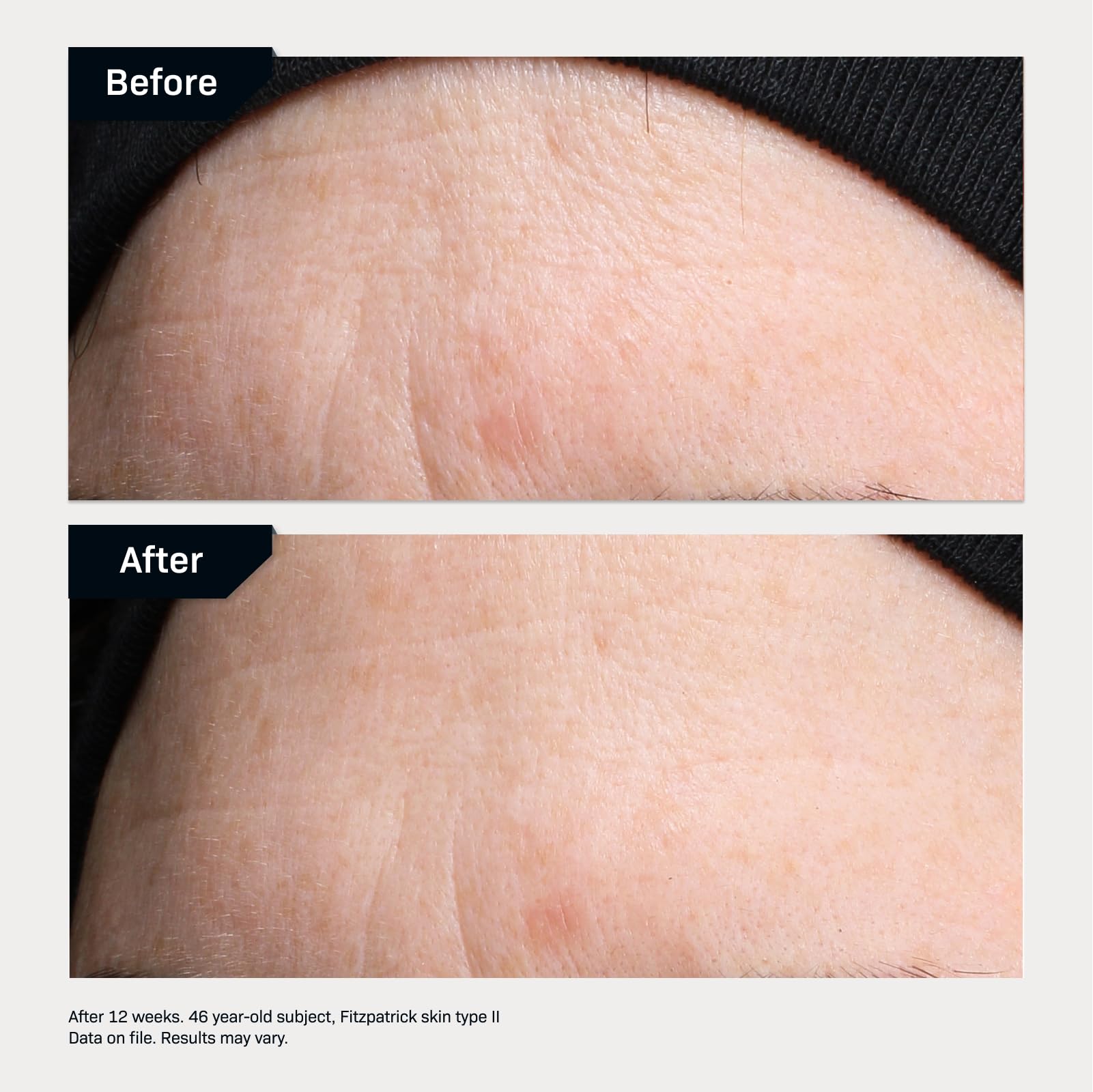 Foto 6 pulgar | Alisador De Línea Serum Revision Skincare Revox™, 7 Ml - Venta Internacional.