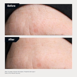 Foto 5 | Alisador De Línea Serum Revision Skincare Revox™, 7 Ml - Venta Internacional.