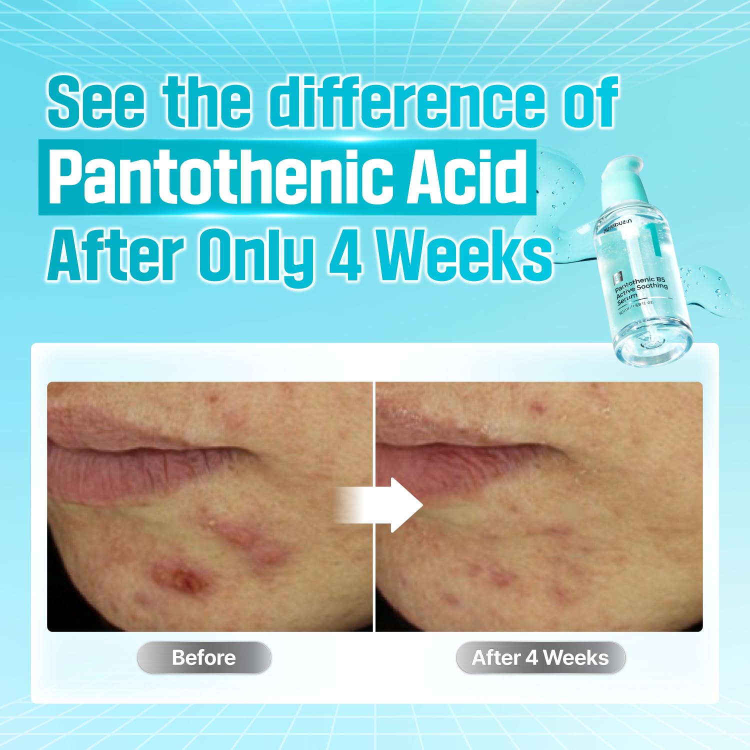 Foto 4 pulgar | Sérum Calmante Numbuzin No.1 Pantoténico B5 Active 50 Ml - Venta Internacional.