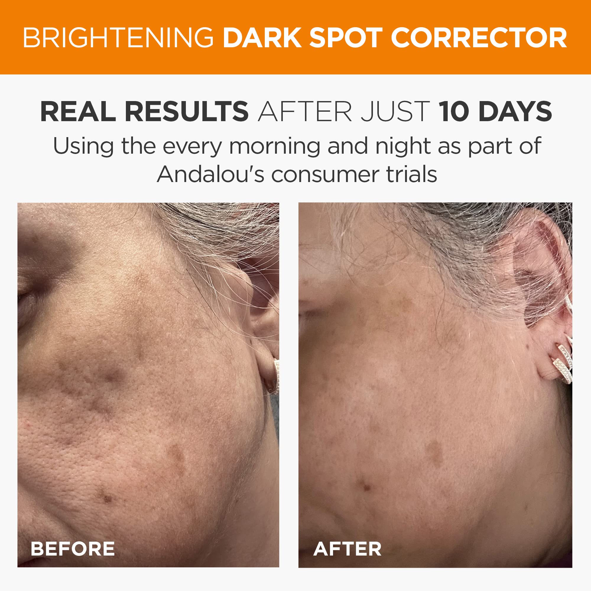 Foto 3 | Sérum Iluminador Andalou Naturals Corrector De Manchas Oscuras 30 Ml - Venta Internacional.
