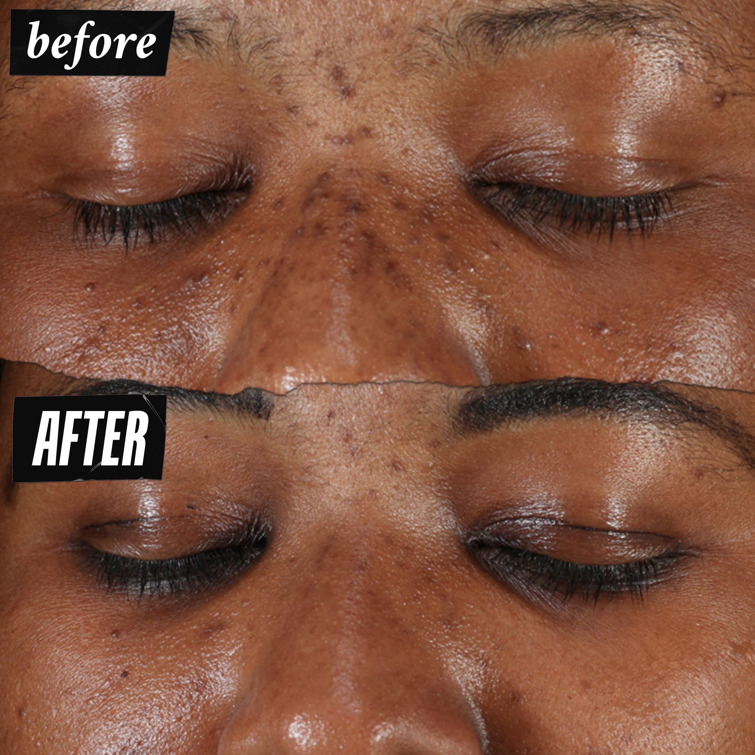Foto 4 pulgar | Sérum Kiehl's Clearly Corrective Dark Spot 15 Ml Con Vitamina C - Venta Internacional.