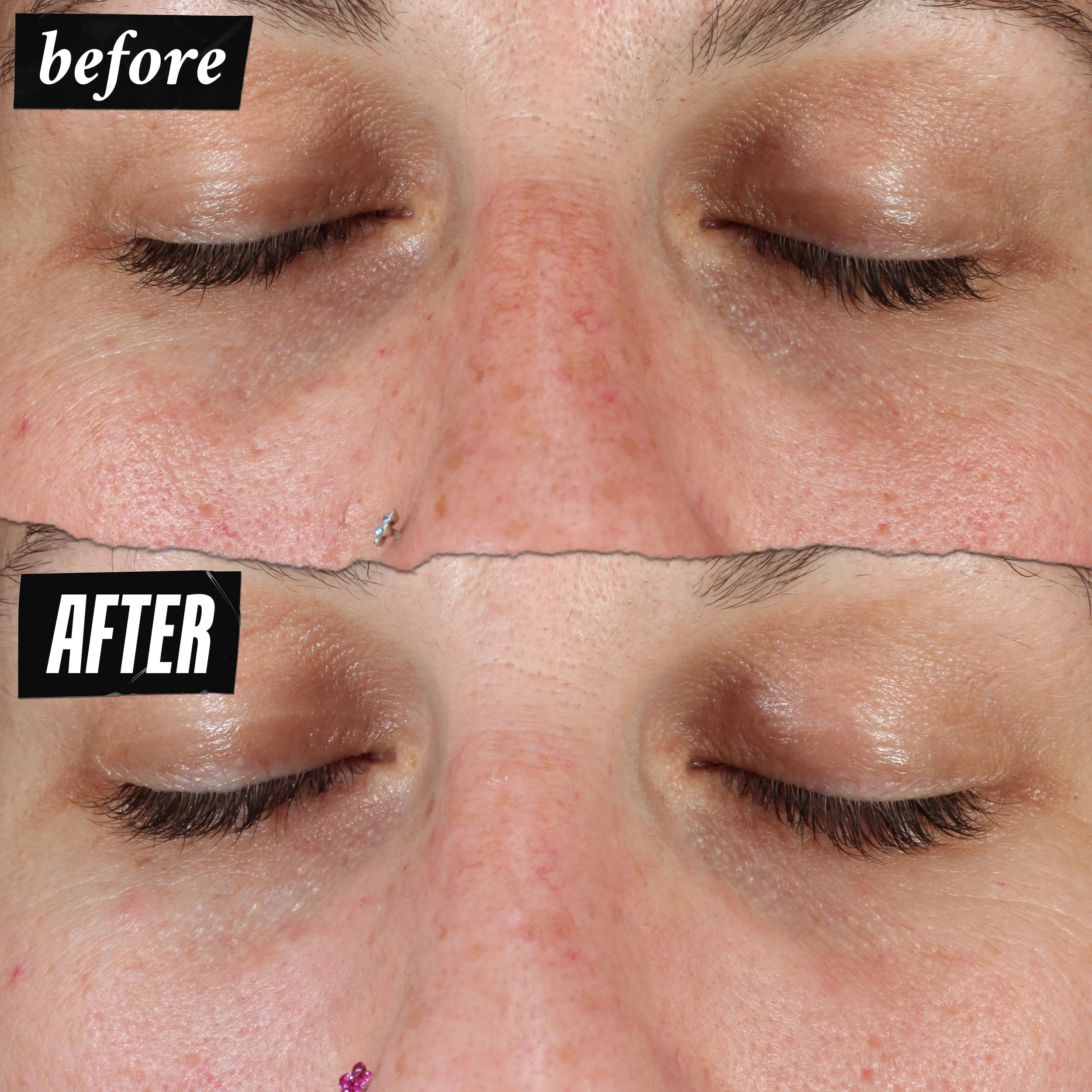 Foto 6 pulgar | Sérum Kiehl's Clearly Corrective Dark Spot 15 Ml Con Vitamina C - Venta Internacional.