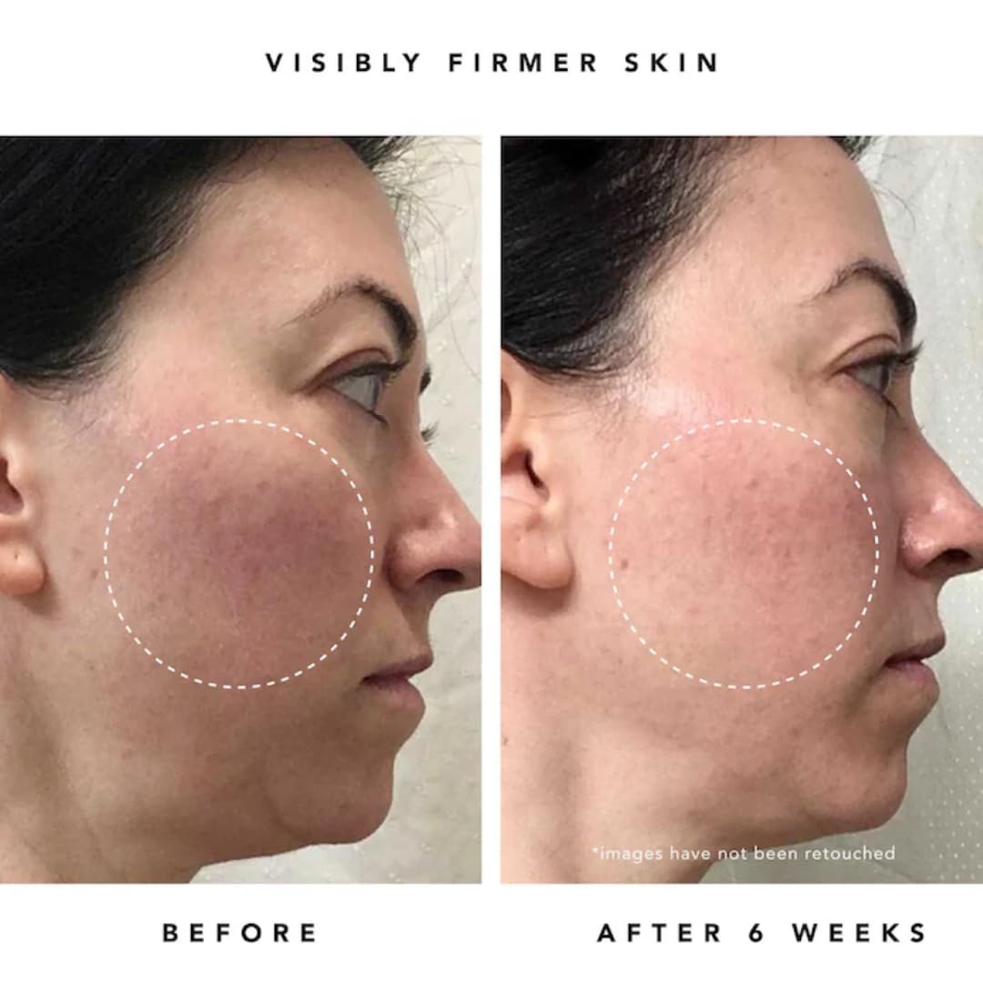 Foto 6 pulgar | Sérum Facial Herbivore Bakuchiol Retinol Alternative 30 Ml - Venta Internacional.