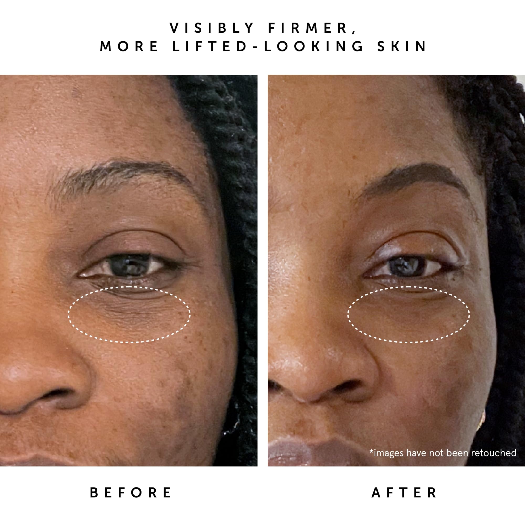 Foto 7 pulgar | Sérum Facial Herbivore Bakuchiol Retinol Alternative 30 Ml - Venta Internacional.