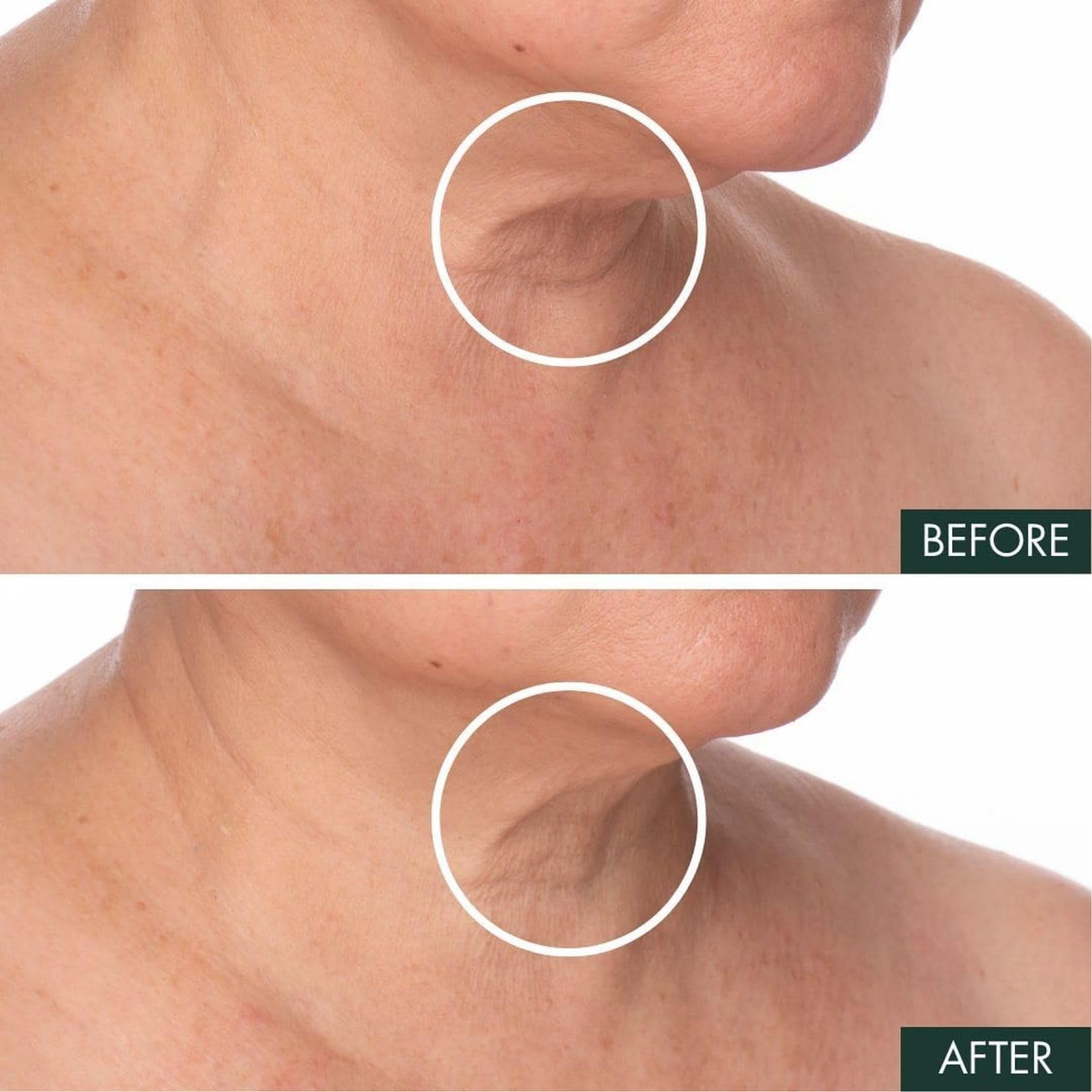 Foto 4 pulgar | Sérum Reafirmante Y Reafirmante Del Cuello Révive Fermitif 50 Ml - Venta Internacional.