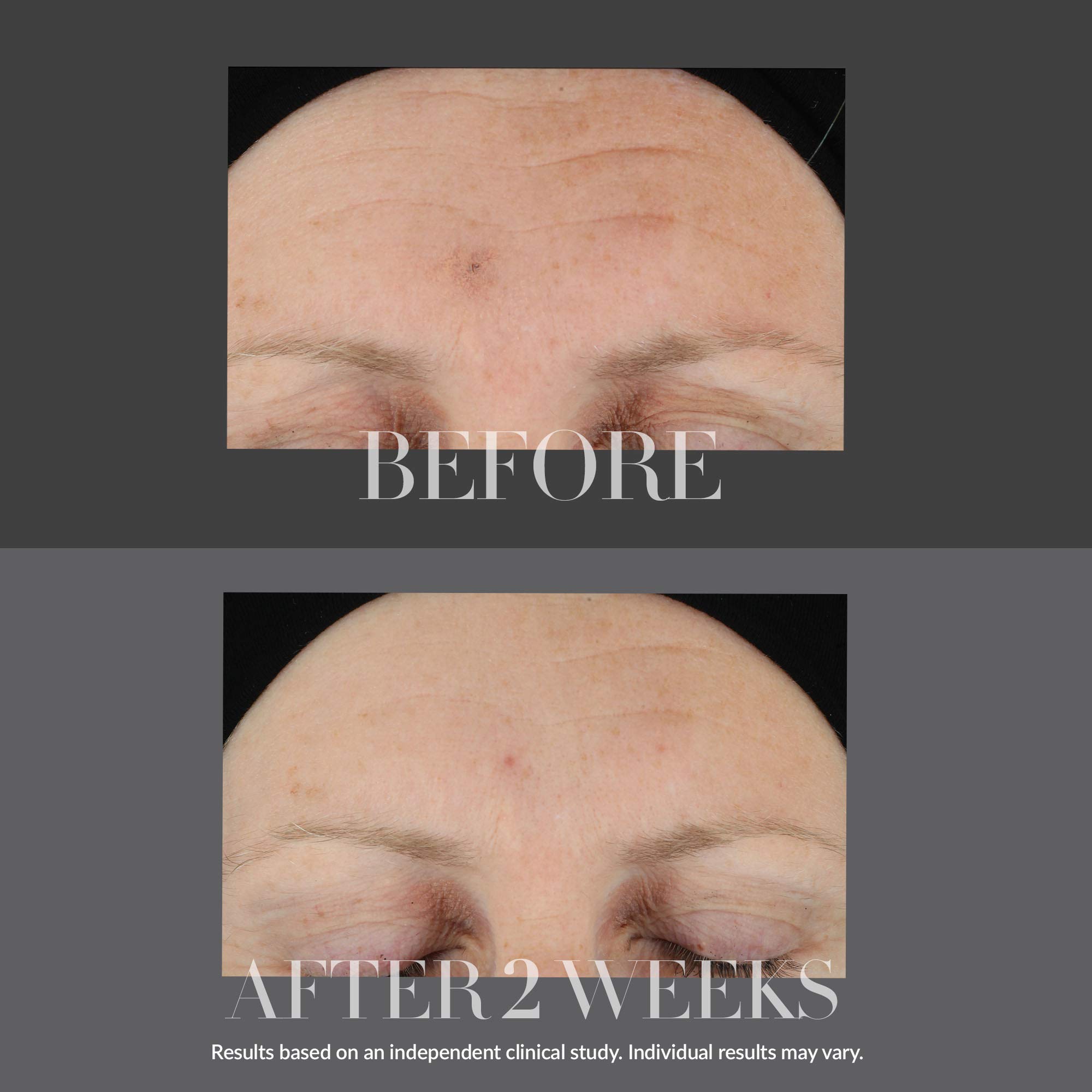 Foto 7 pulgar | Sérum Reafirmante Kate Somerville Kateceuticals, 30 Ml, Antienvejecimiento - Venta Internacional.