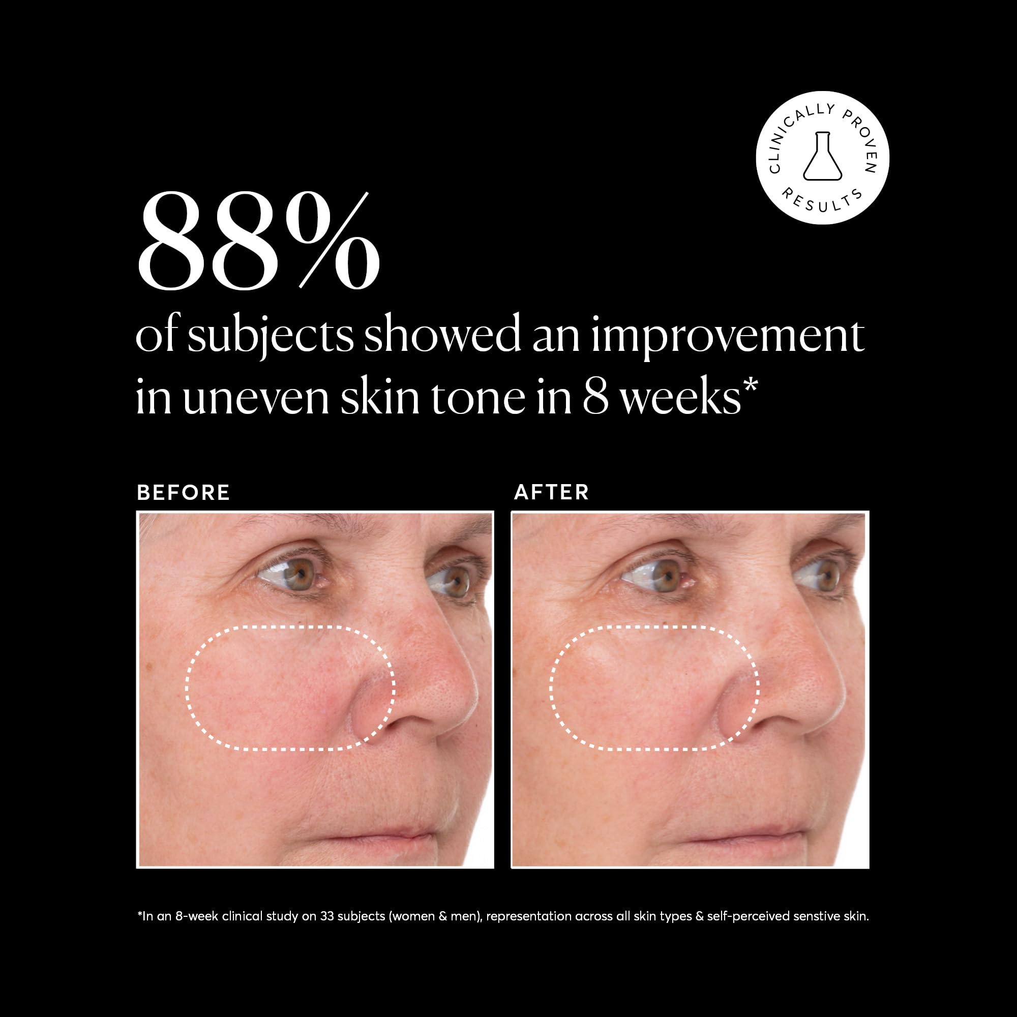 Foto 5 | Serum Naturium Super Serum Plus Con Vitamina C, 60 Ml - Venta Internacional.