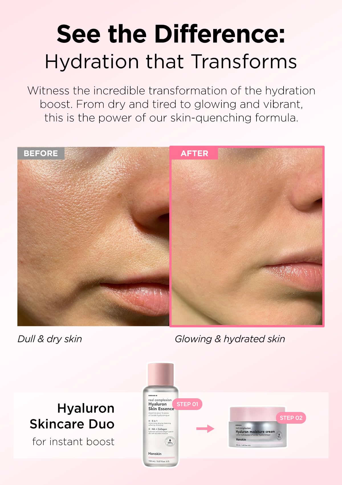 Foto 4 pulgar | Crema Hidratante Hanskin Real Complexion Hyaluronic 50 ml - Venta Internacional