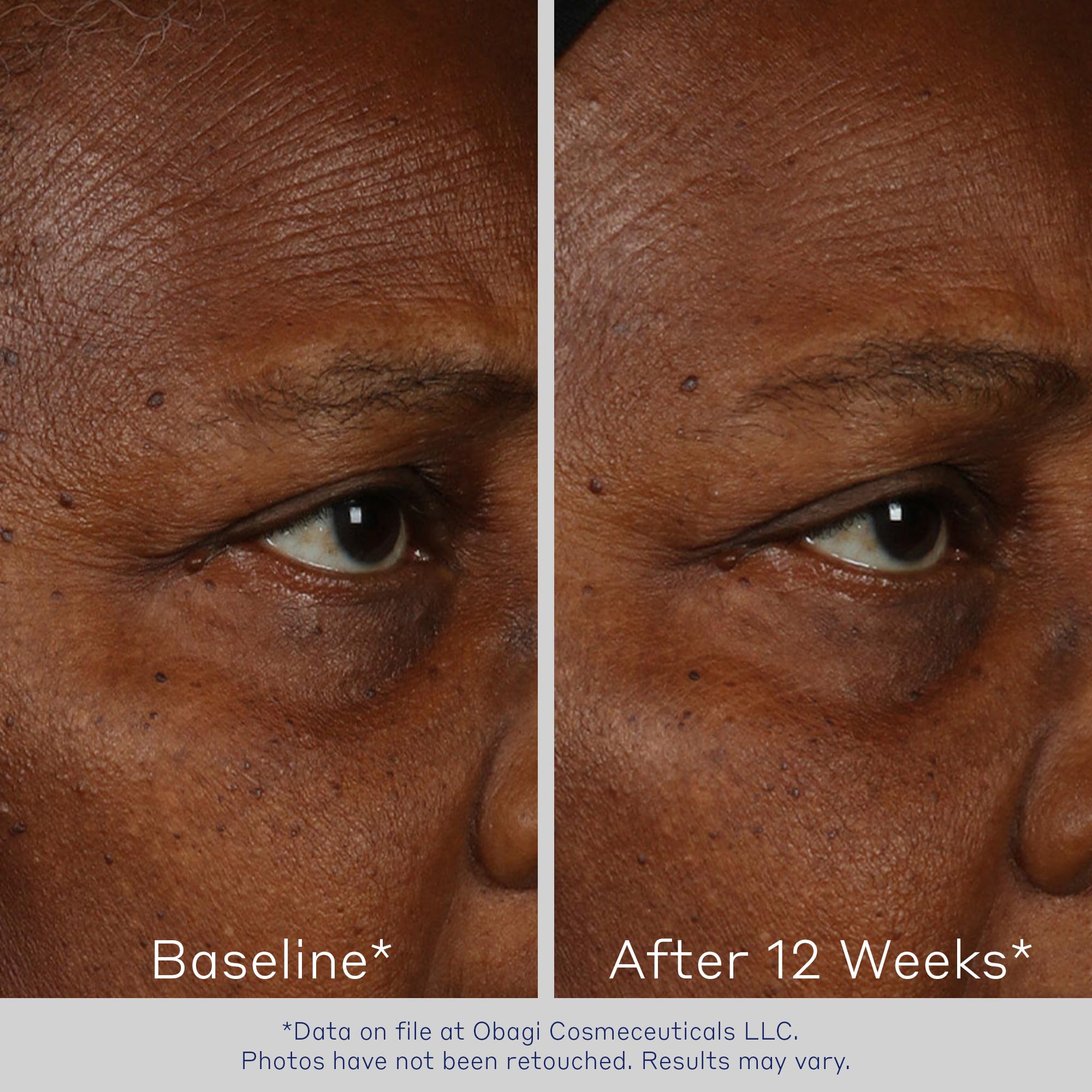 Foto 2 | Sérum Facial Obagi Elastiderm Reafirmante Con Bimineral De 60 Ml, Paquete De 2 - Venta Internacional.