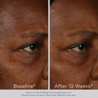 Foto 2 | Sérum Facial Obagi Elastiderm Reafirmante Con Bimineral De 60 Ml, Paquete De 2 - Venta Internacional.