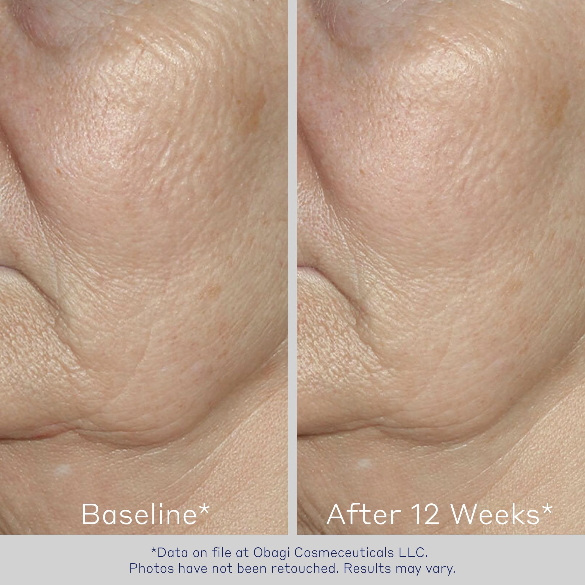 Foto 7 pulgar | Sérum Facial Obagi Elastiderm Reafirmante Con Bimineral De 60 Ml, Paquete De 2 - Venta Internacional.
