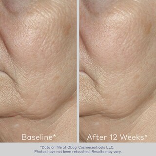 Foto 6 | Sérum Facial Obagi Elastiderm Reafirmante Con Bimineral De 60 Ml, Paquete De 2 - Venta Internacional.