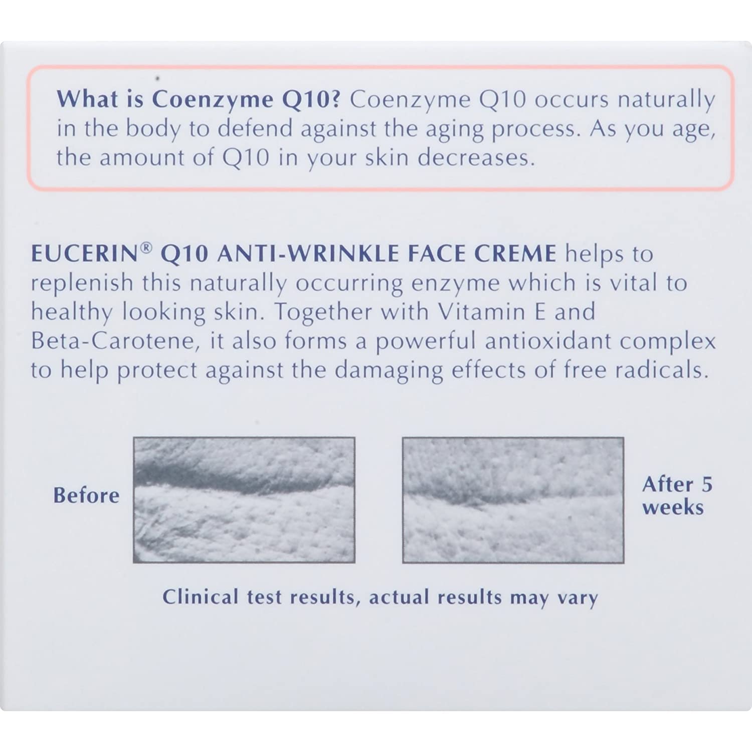 Foto 7 pulgar | Crema Facial Eucerin Sensitive Skin Q10 Antiarrugas 50 Ml X5 - Venta Internacional.