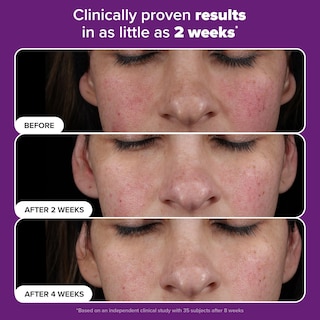 Foto 3 | Sérum Paula's Choice Pro Retinaldehyde Dual-retinoid 30 Ml - Venta Internacional.