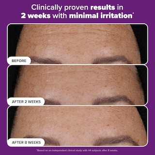 Foto 4 | Sérum Paula's Choice Pro Retinaldehyde Dual-retinoid 30 Ml - Venta Internacional.