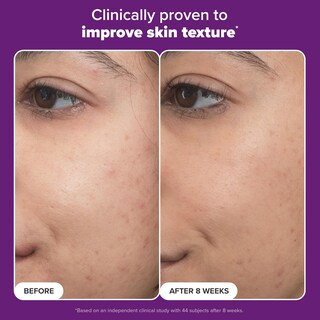 Foto 5 | Sérum Paula's Choice Pro Retinaldehyde Dual-retinoid 30 Ml - Venta Internacional.