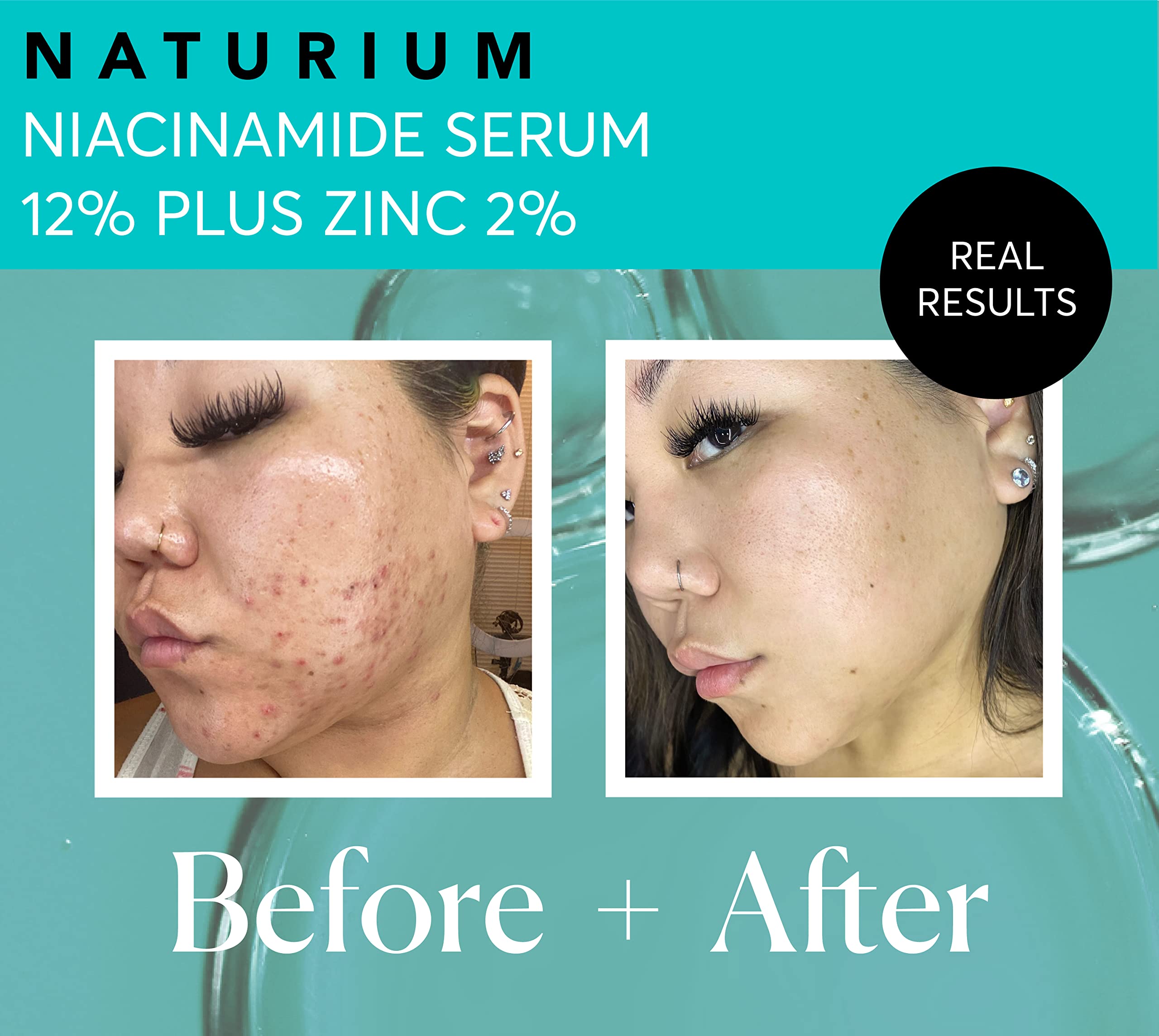 Foto 6 pulgar | Sérum Facial Naturium Niacinamide 12% + Zinc 2% Con Ácido Hialurónico - Venta Internacional.