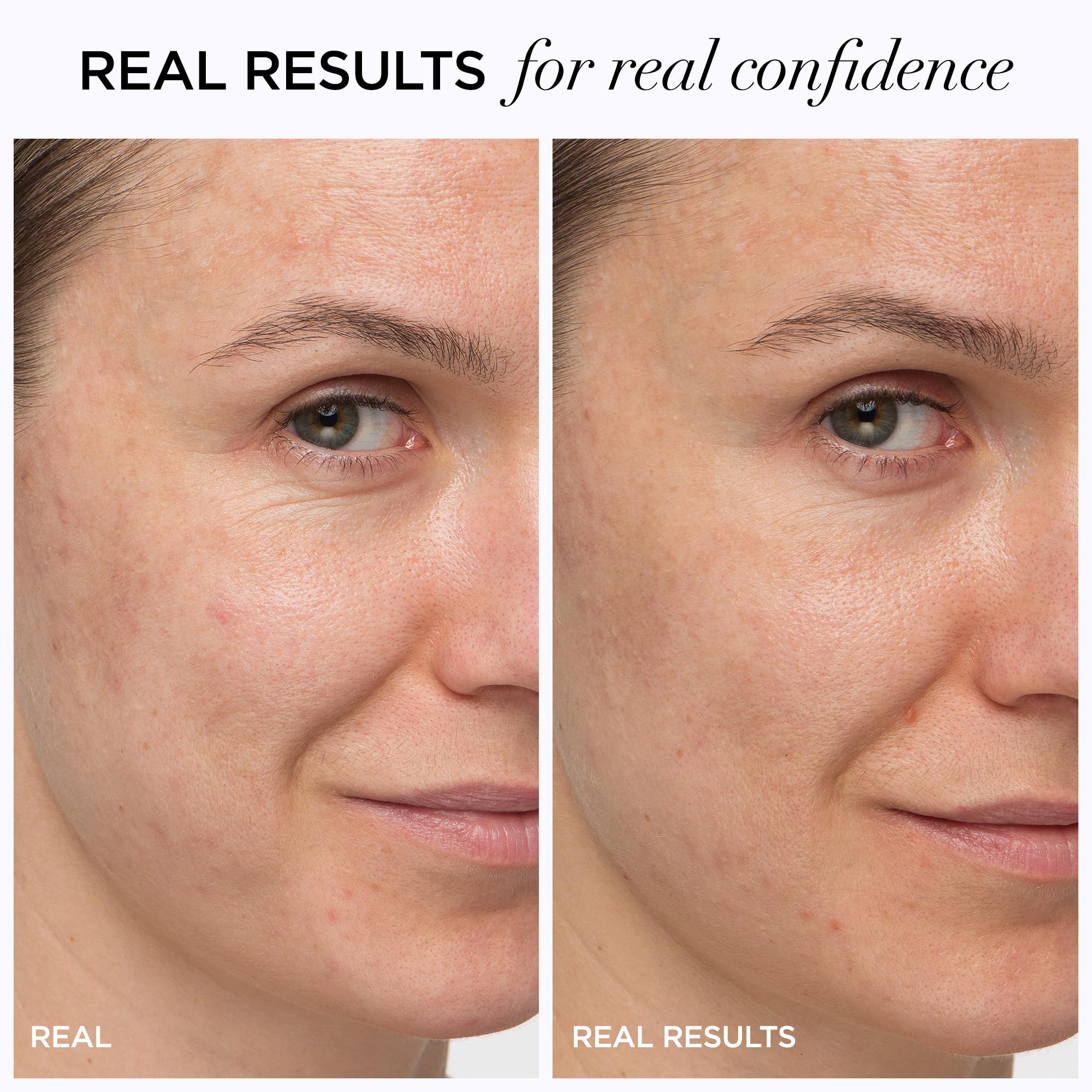 Foto 4 pulgar | Crema Hidratante Antiedad Confidence In A Cream De It Cosmetics, 60 Ml - Venta Internacional.