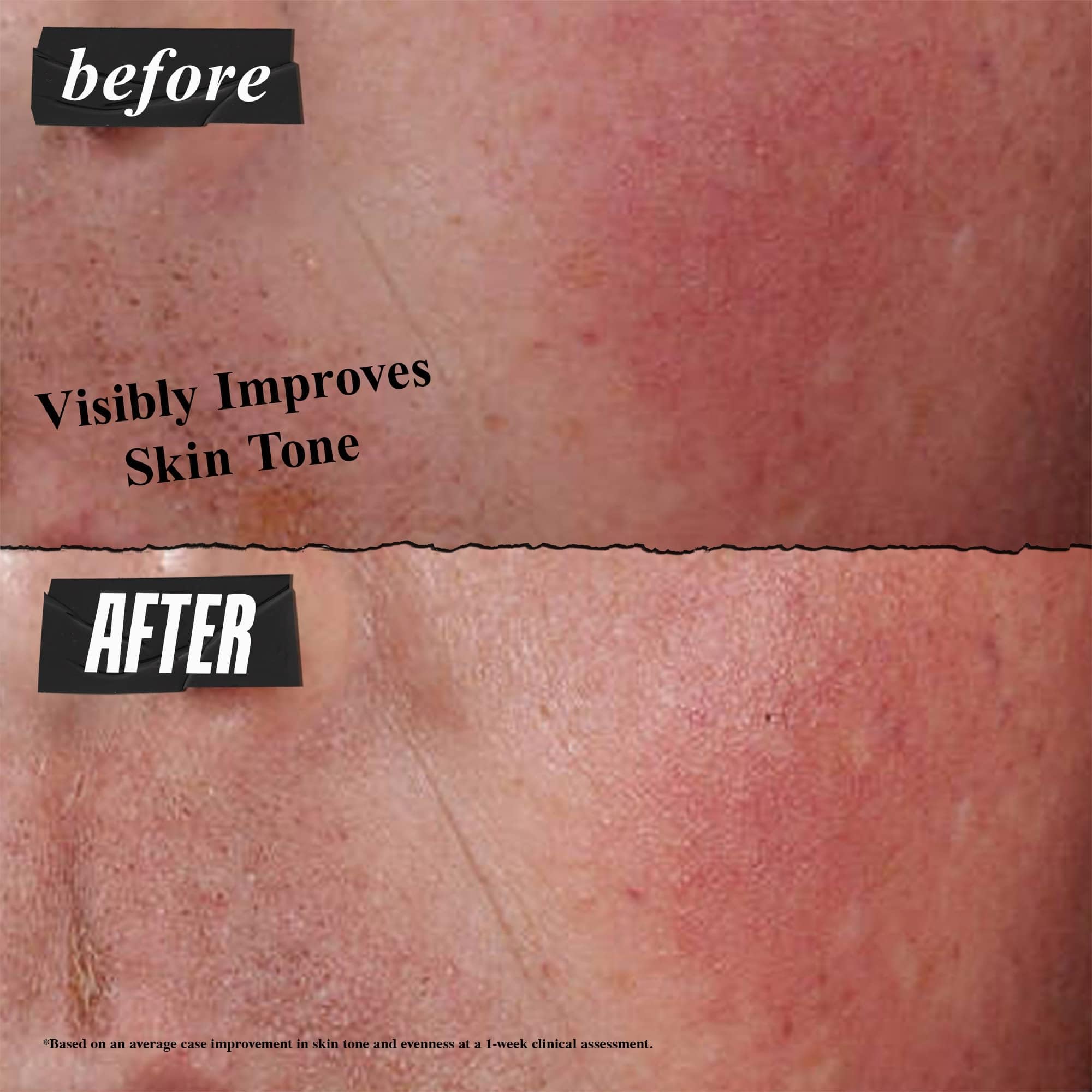 Foto 4 pulgar | Crema Protectora Kiehl's Ultra Facial Advanced Repair 50 Ml - Venta Internacional.