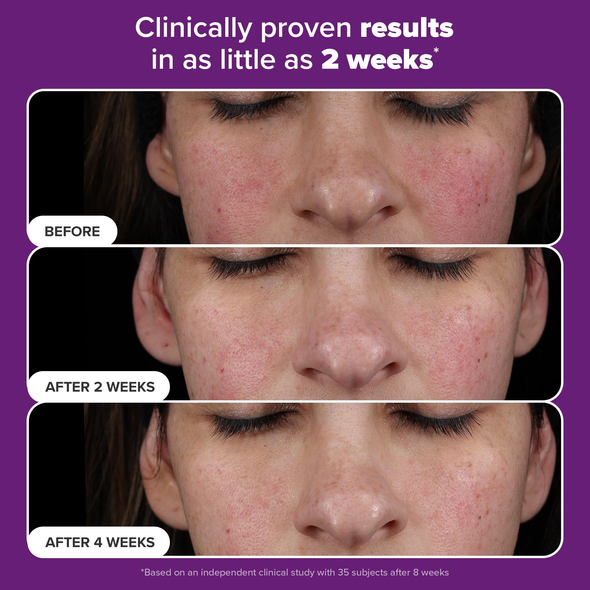 Foto 4 pulgar | Sérum Paula's Choice Pro Retinaldehyde Dual-retinoid 5 Ml - Venta Internacional.