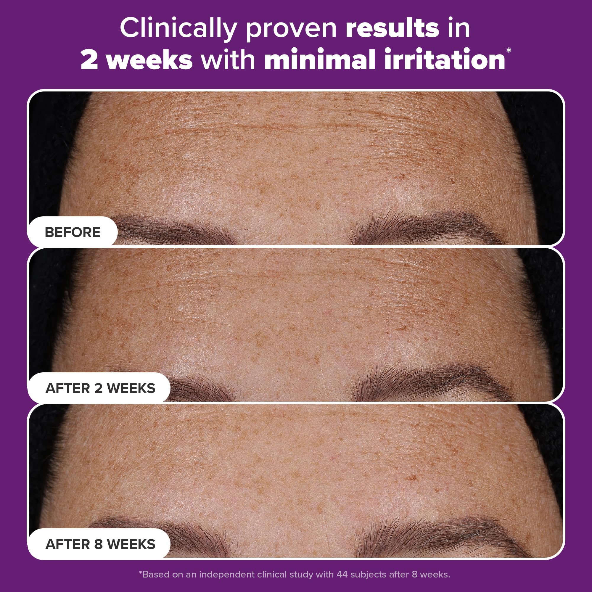 Foto 5 pulgar | Sérum Paula's Choice Pro Retinaldehyde Dual-retinoid 5 Ml - Venta Internacional.