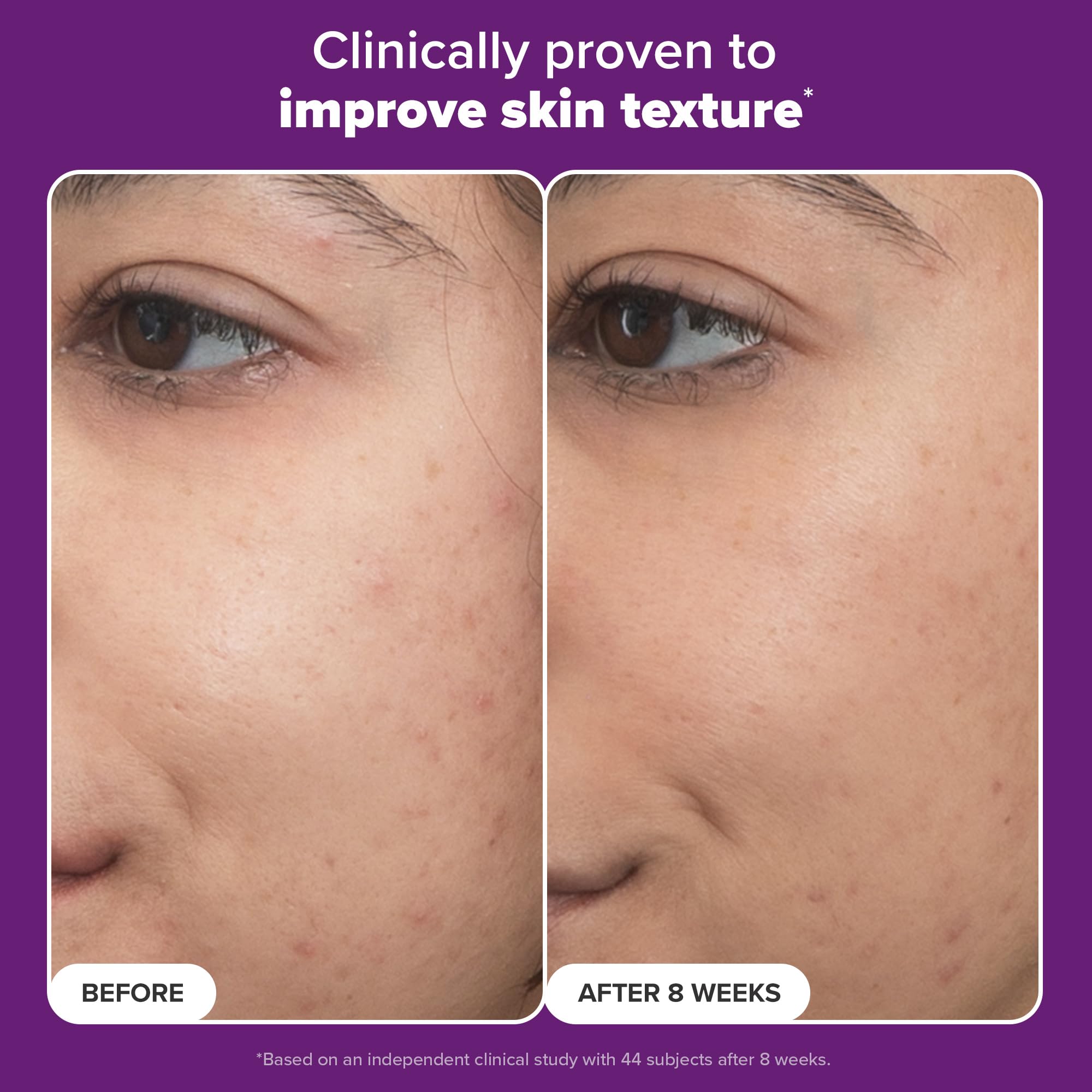Foto 6 pulgar | Sérum Paula's Choice Pro Retinaldehyde Dual-retinoid 5 Ml - Venta Internacional.