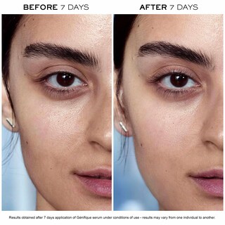Foto 4 | Sérum Facial Lancôme Advanced Génifique Radiance Boosting 30 Ml - Venta Internacional.