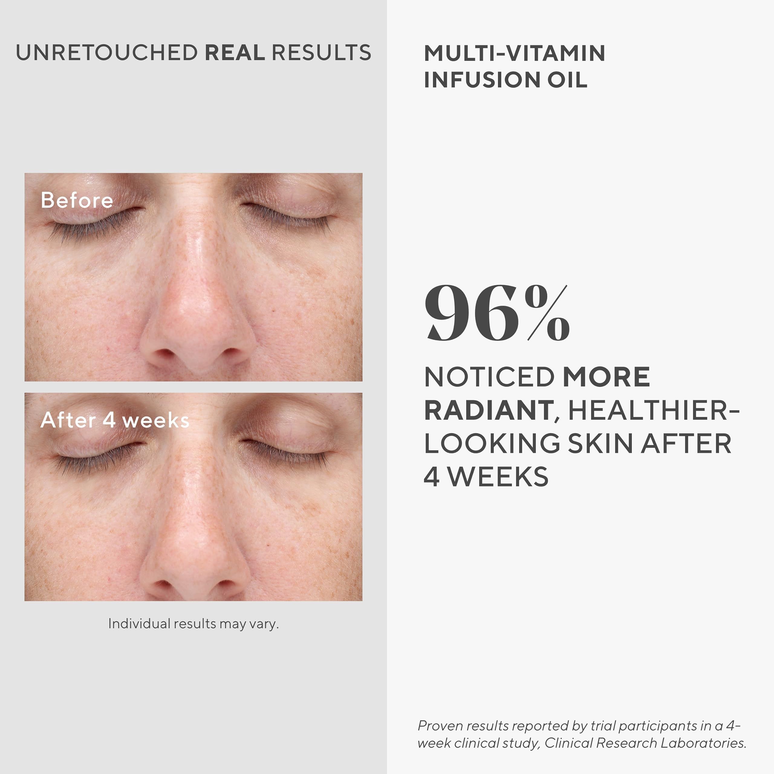 Foto 3 | Aceite Facial Murad, Infusión Multivitamínica, Hidratación, 30 Ml - Venta Internacional.
