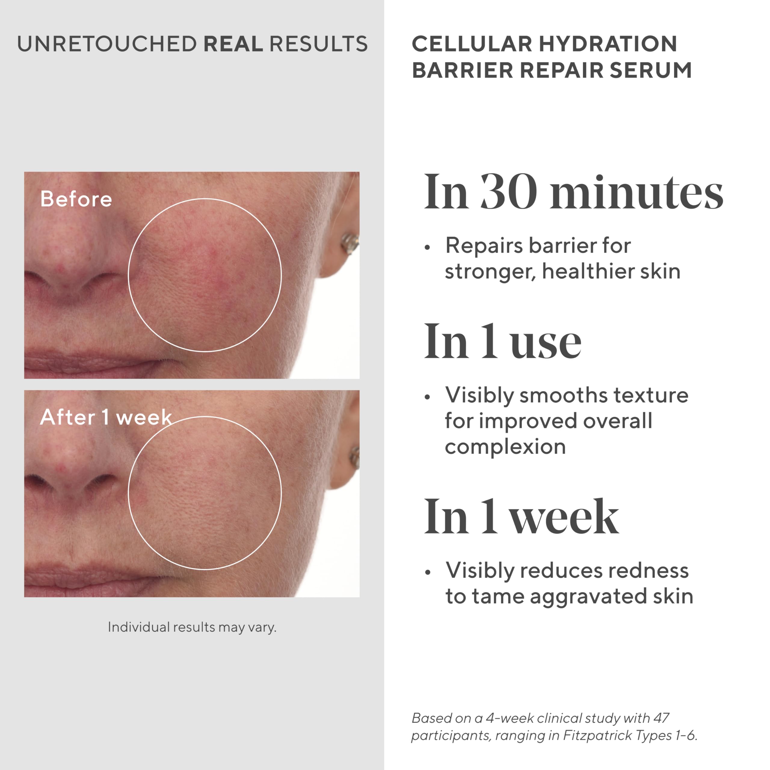Foto 4 pulgar | Suero Reparador Murad Cellular Hydration 30 Ml - Venta Internacional