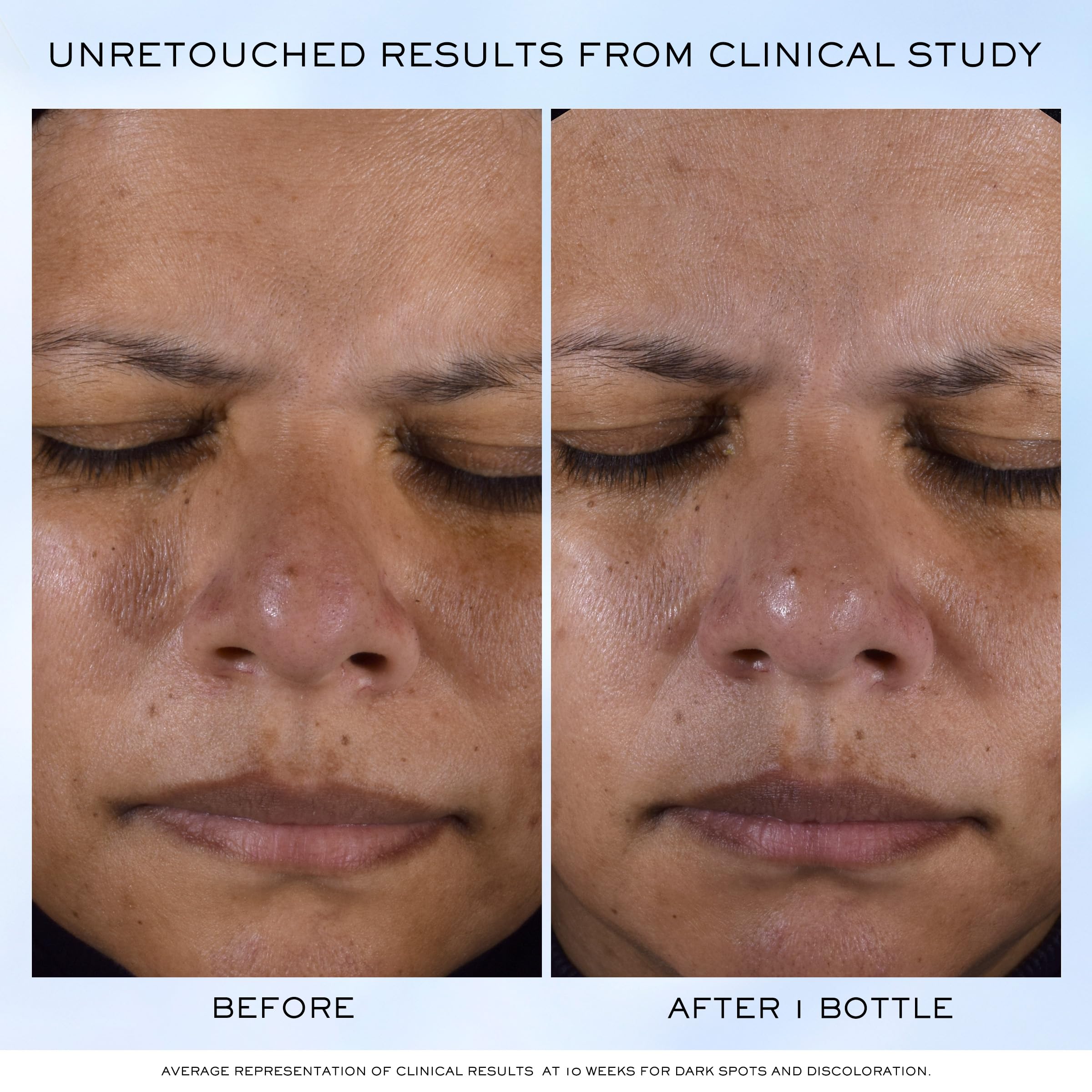 Foto 6 pulgar | Sérum Facial Lancôme Clarifique Pro-solution 30 Ml Con 10% De Pha - Venta Internacional.