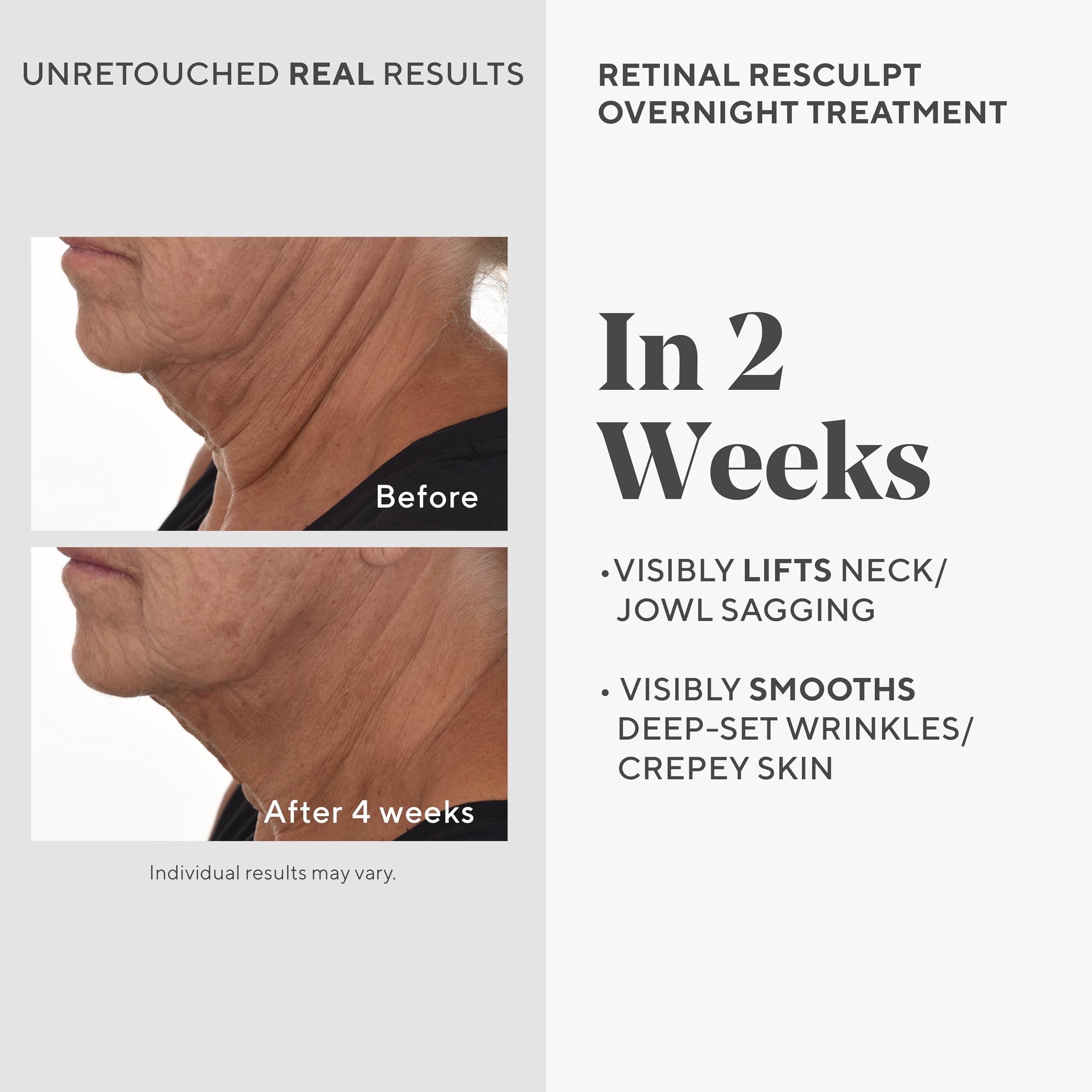 Foto 4 pulgar | Serum Murad Retinal Resculpt, Tratamiento Nocturno, 30 Ml - Venta Internacional.