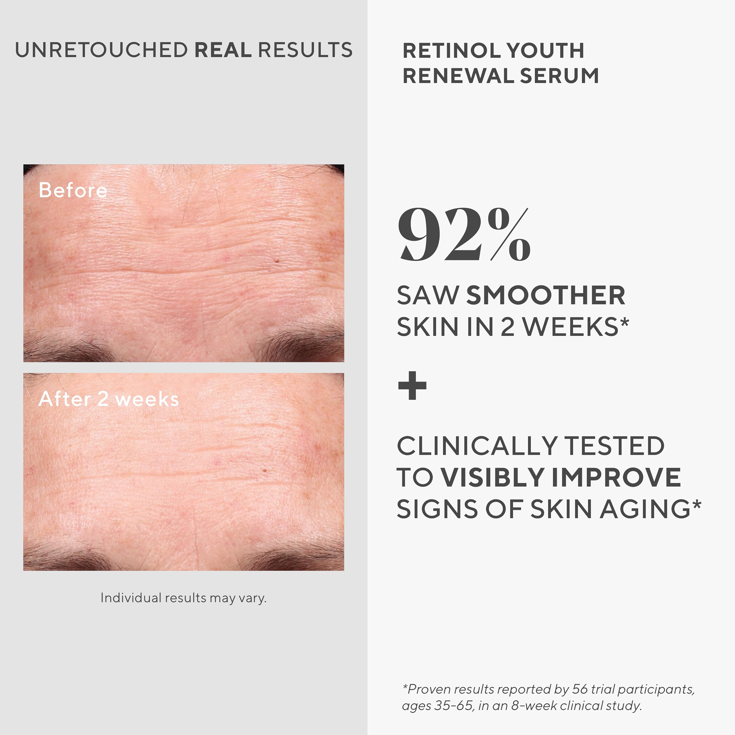 Foto 5 pulgar | Sérum Murad Retinol Youth Renewal Resurgence 50 Ml - Venta Internacional