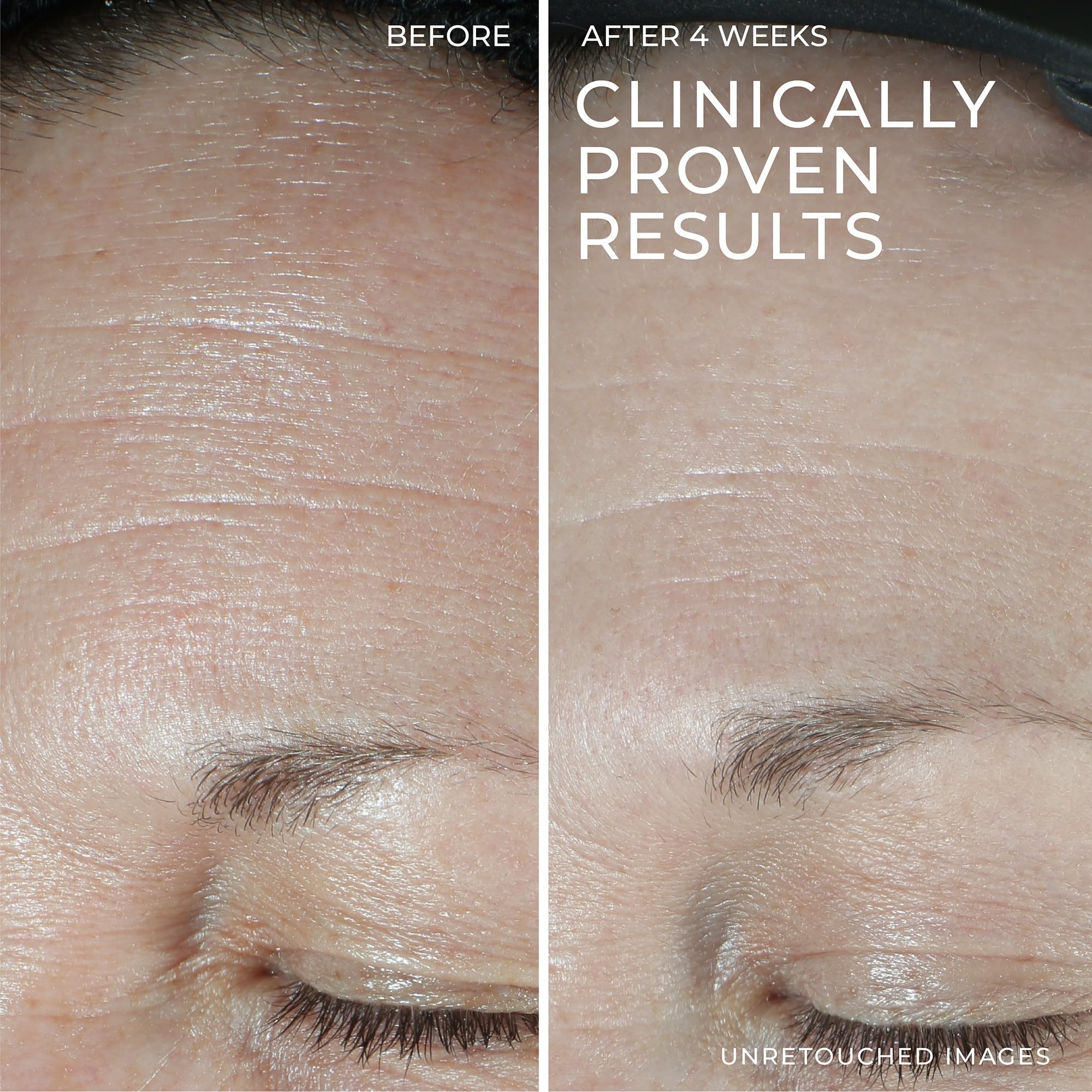 Foto 5 | Crema Facial Hidratante Roc Hydration+ Con Ácido Hialurónico 50 Ml - Venta Internacional.