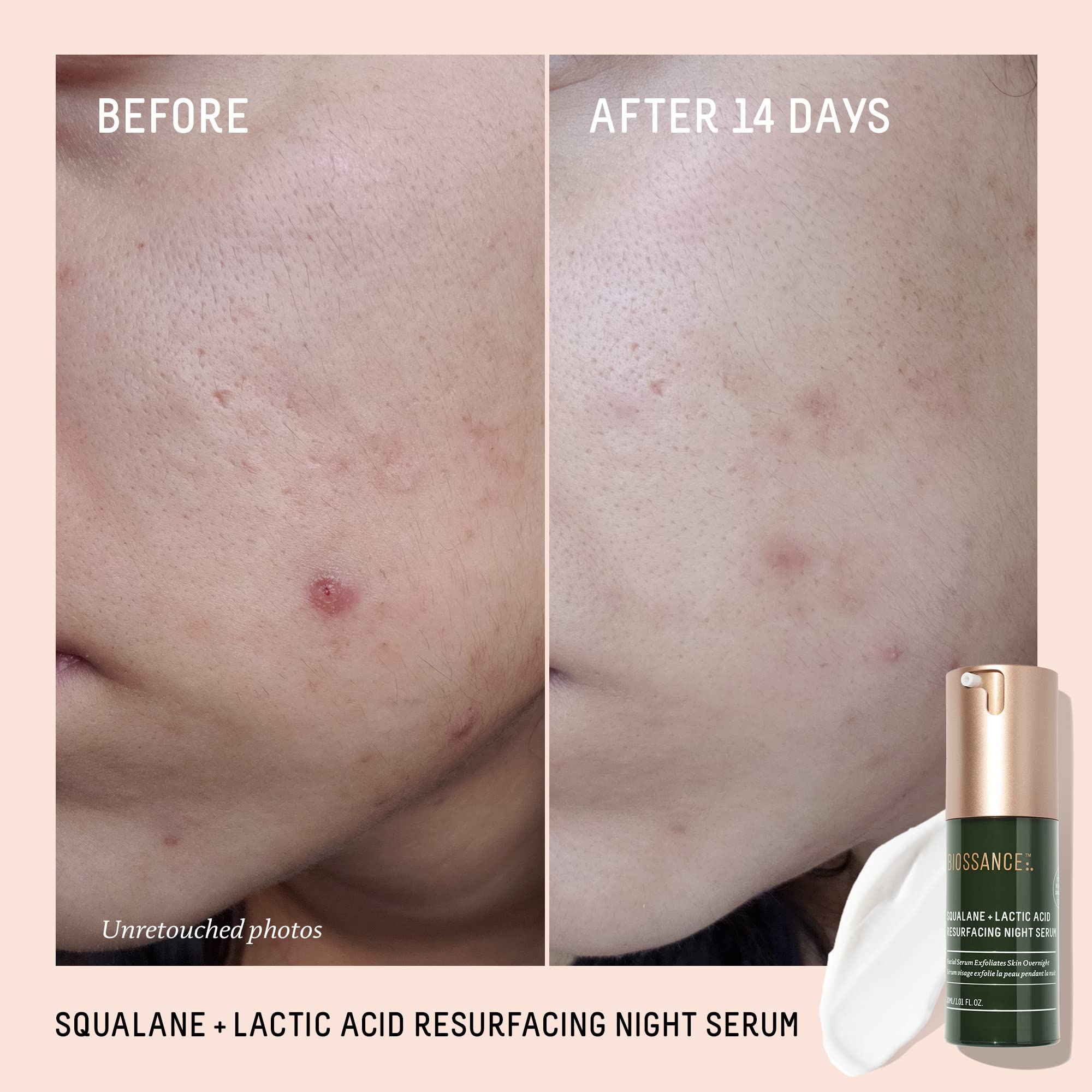 Foto 3 pulgar | Sérum De Noche Biossance Squalane + Ácido Láctico 30 Ml - Venta Internacional.