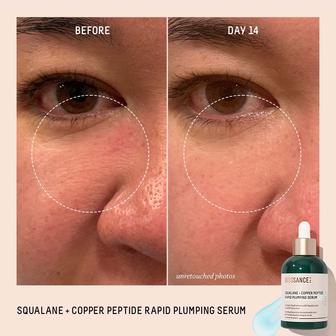 Foto 5 pulgar | Sérum Facial Biossance Squalane + Peptido De Cobre 50 Ml - Venta Internacional.