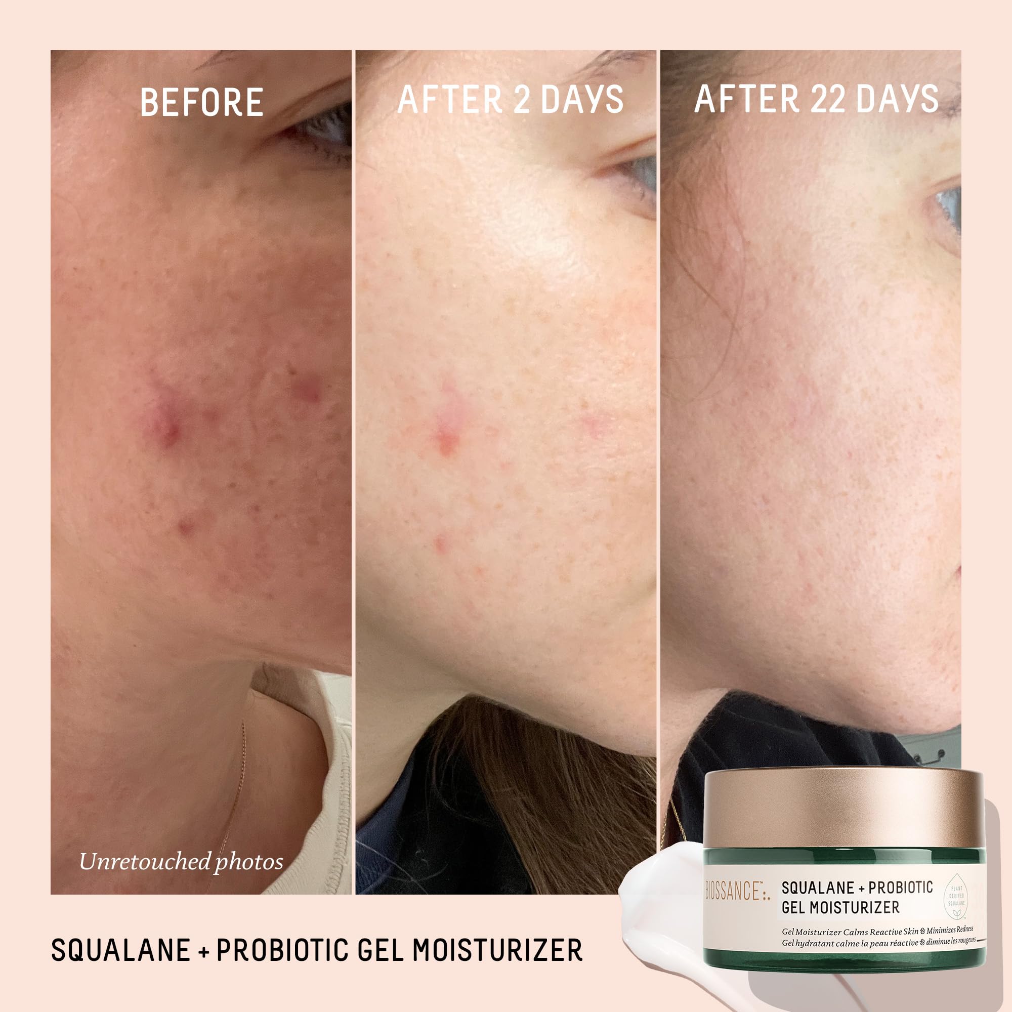 Foto 3 | Hidratante Biossance Squalane + Gel Equilibrante Probiótico 50 Ml - Venta Internacional.