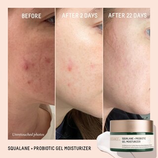 Foto 3 | Hidratante Biossance Squalane + Gel Equilibrante Probiótico 50 Ml - Venta Internacional.
