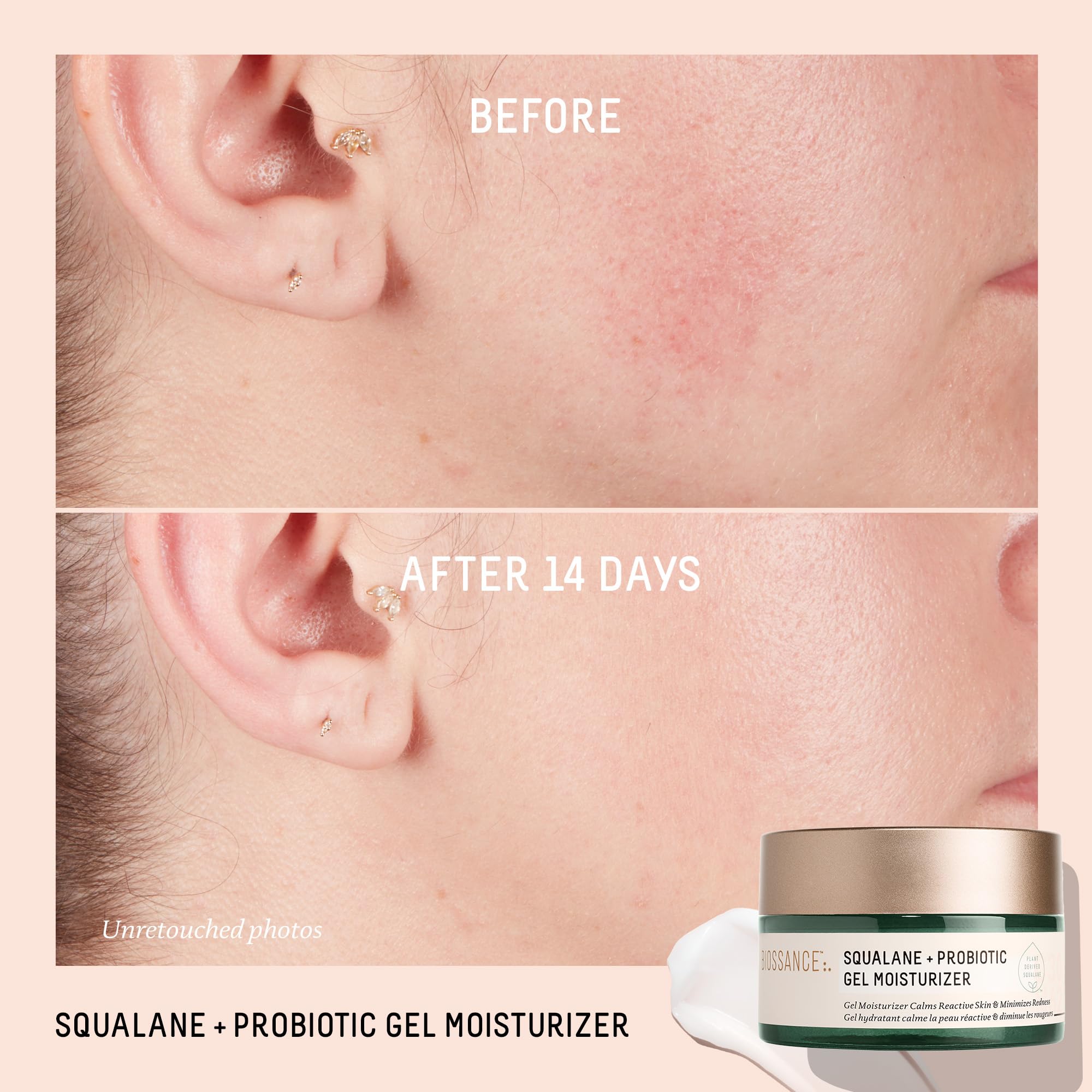 Foto 5 pulgar | Hidratante Biossance Squalane + Gel Equilibrante Probiótico 50 Ml - Venta Internacional.