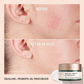 Foto 4 | Hidratante Biossance Squalane + Gel Equilibrante Probiótico 50 Ml - Venta Internacional.