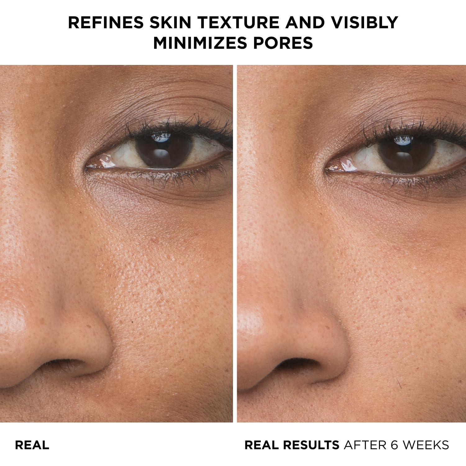 Foto 2 | Sérum Facial It Cosmetics Bye Bye Pores con 10% de Ácido Glicólico 30 ml - Venta Internacional