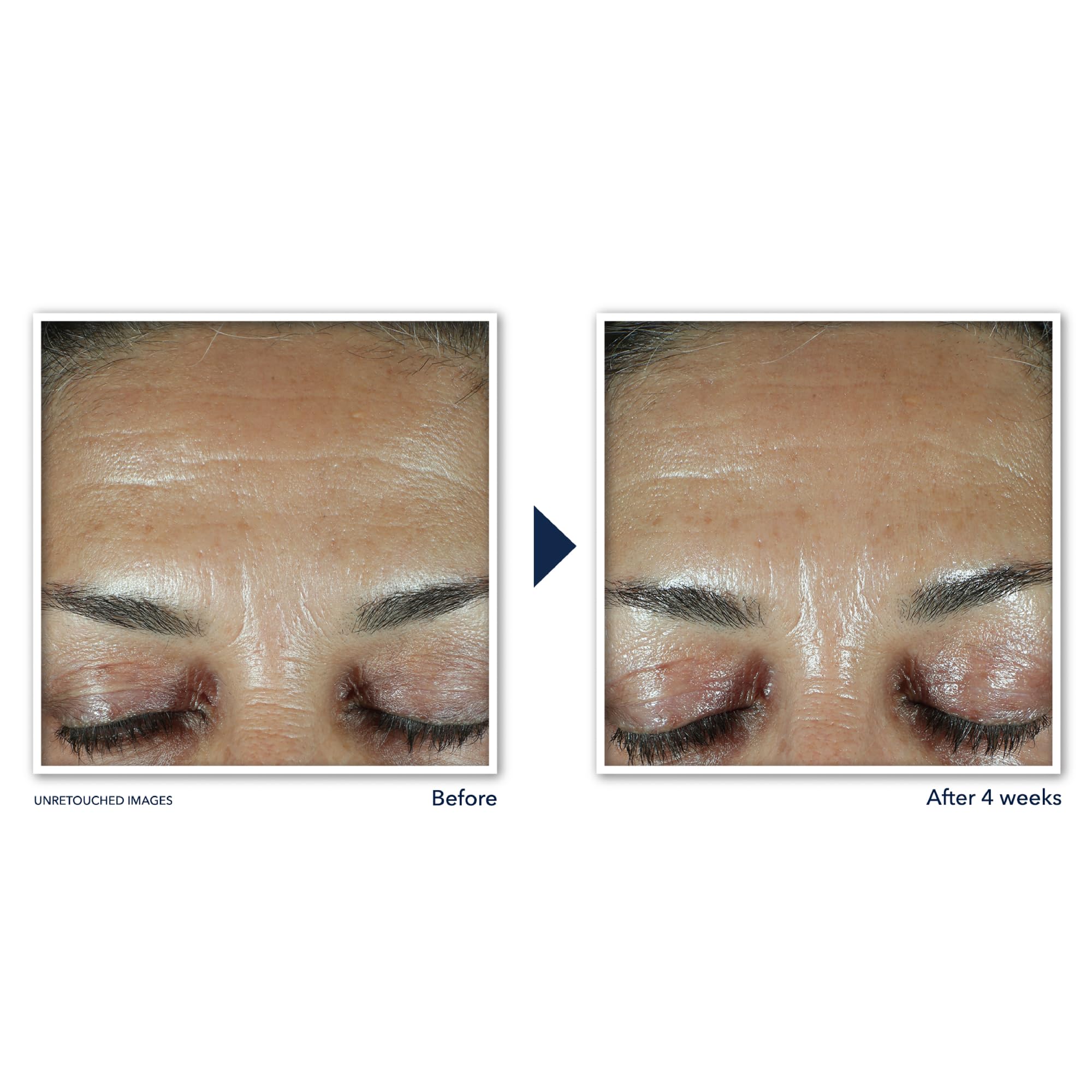 Foto 4 pulgar | Relleno Facial Roc Retinol Correxion Deep Wrinkle 30 Ml - Venta Internacional.