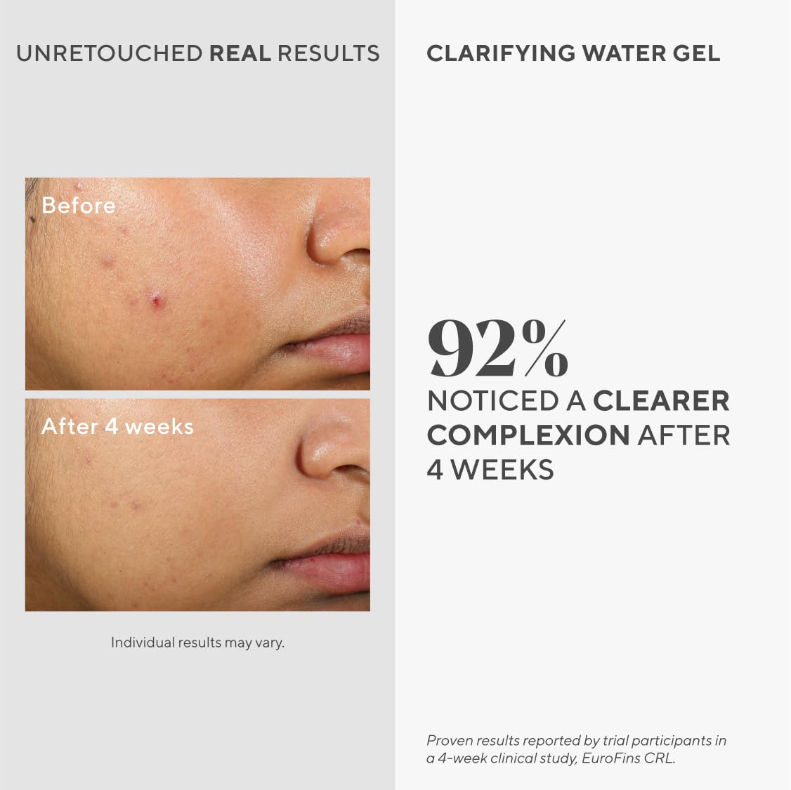 Foto 3 pulgar | Gel de Agua Clarificante Hidratante Murad 60 ml para Rostro - Venta Internacional