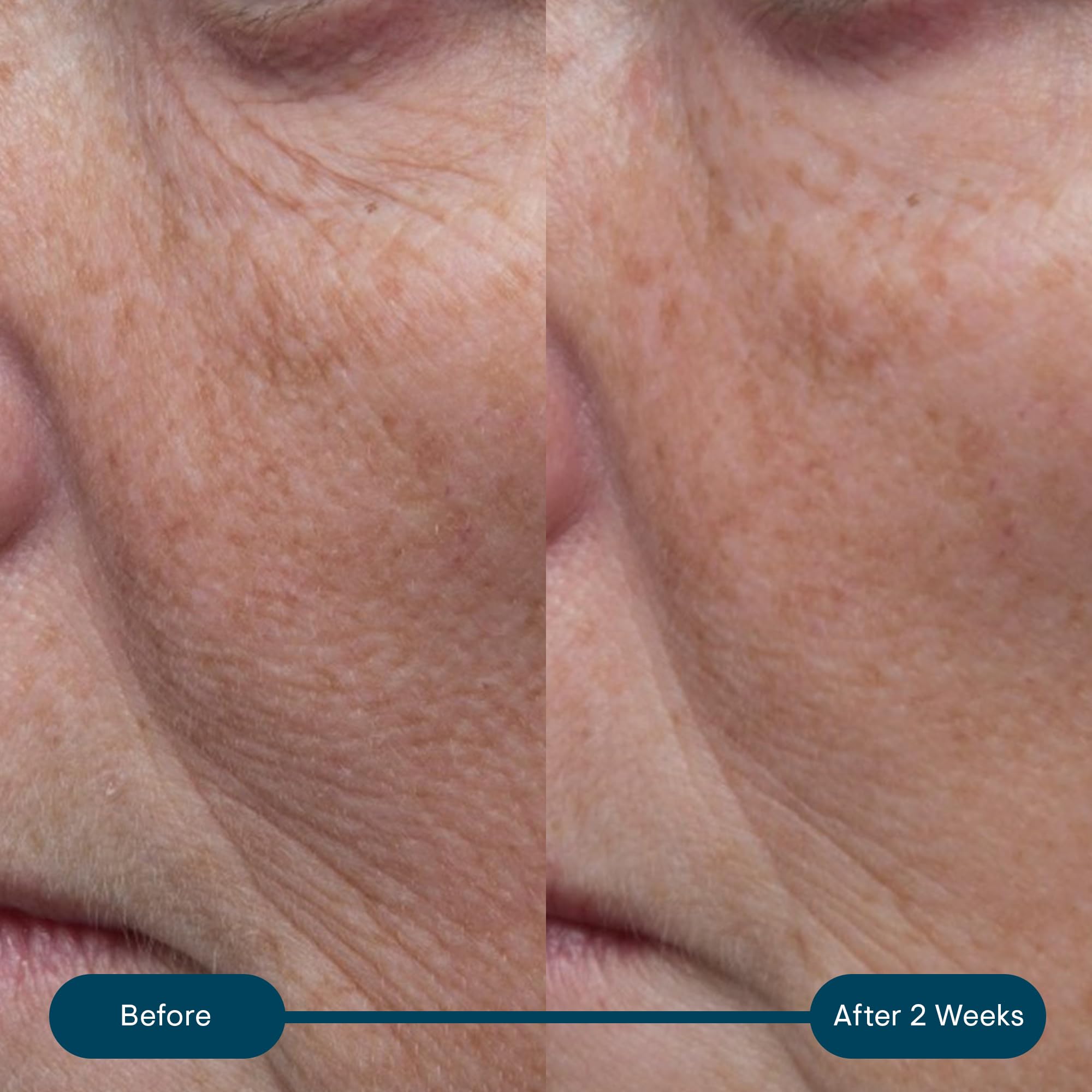 Foto 5 pulgar | Crema Hidratante Elemis Pro-collagen Marine Spf 30 - Venta Internacional