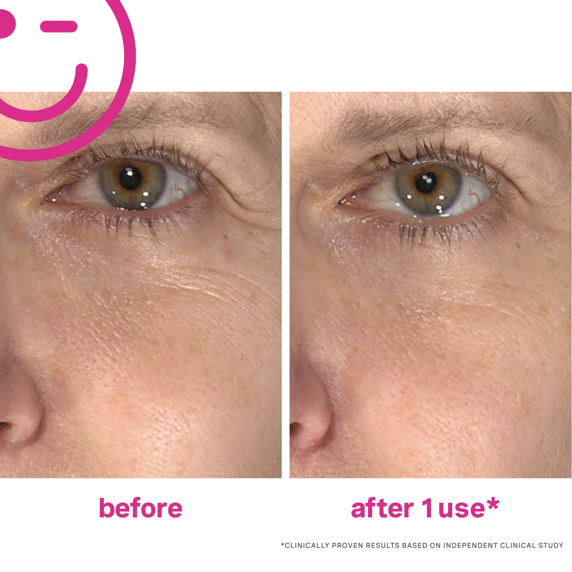 Foto 4 pulgar | Crema Hidratante Y Sérum Facial Kate Somerville Wrinkle Warrior 50 Ml - Venta Internacional.