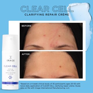 Foto 5 | Crema De Noche En Gel Hidratante Image Skincare Clear Cell 50 Ml - Venta Internacional.